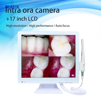 Diş ağız içi kamera M-978(2-in-1) + Kendi Kendine Yeten 17 İnç LED HD Tam Ekran Monitör Kablosuz Wi-Fi Oral Endoskop